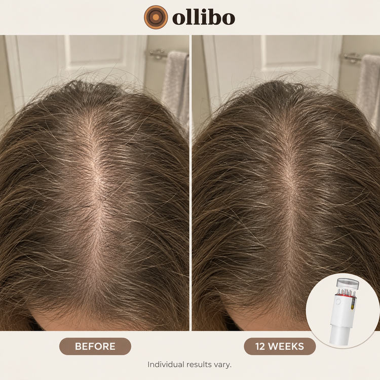 Ollibo Scalp Brush for Fuller, Thicker-Looking Hair